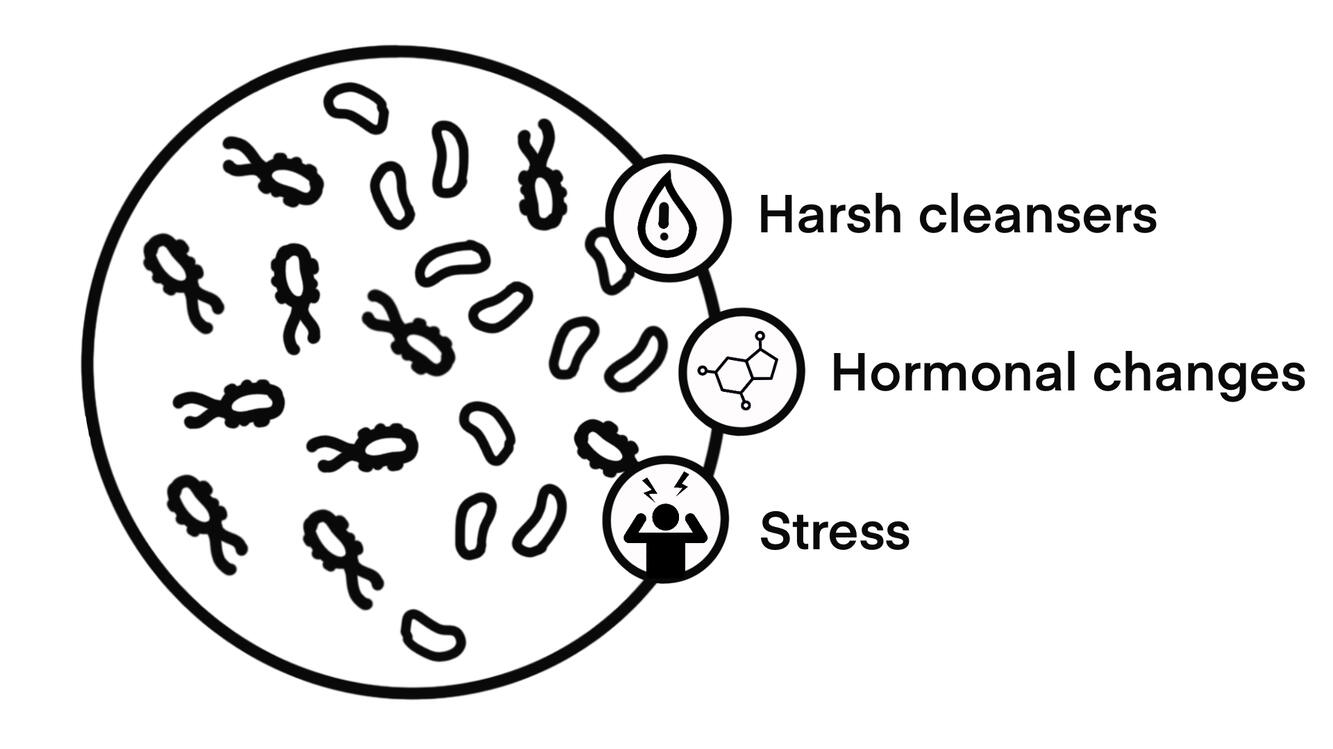 Harsh cleansers, stress, and hormonal changes don’t help.
