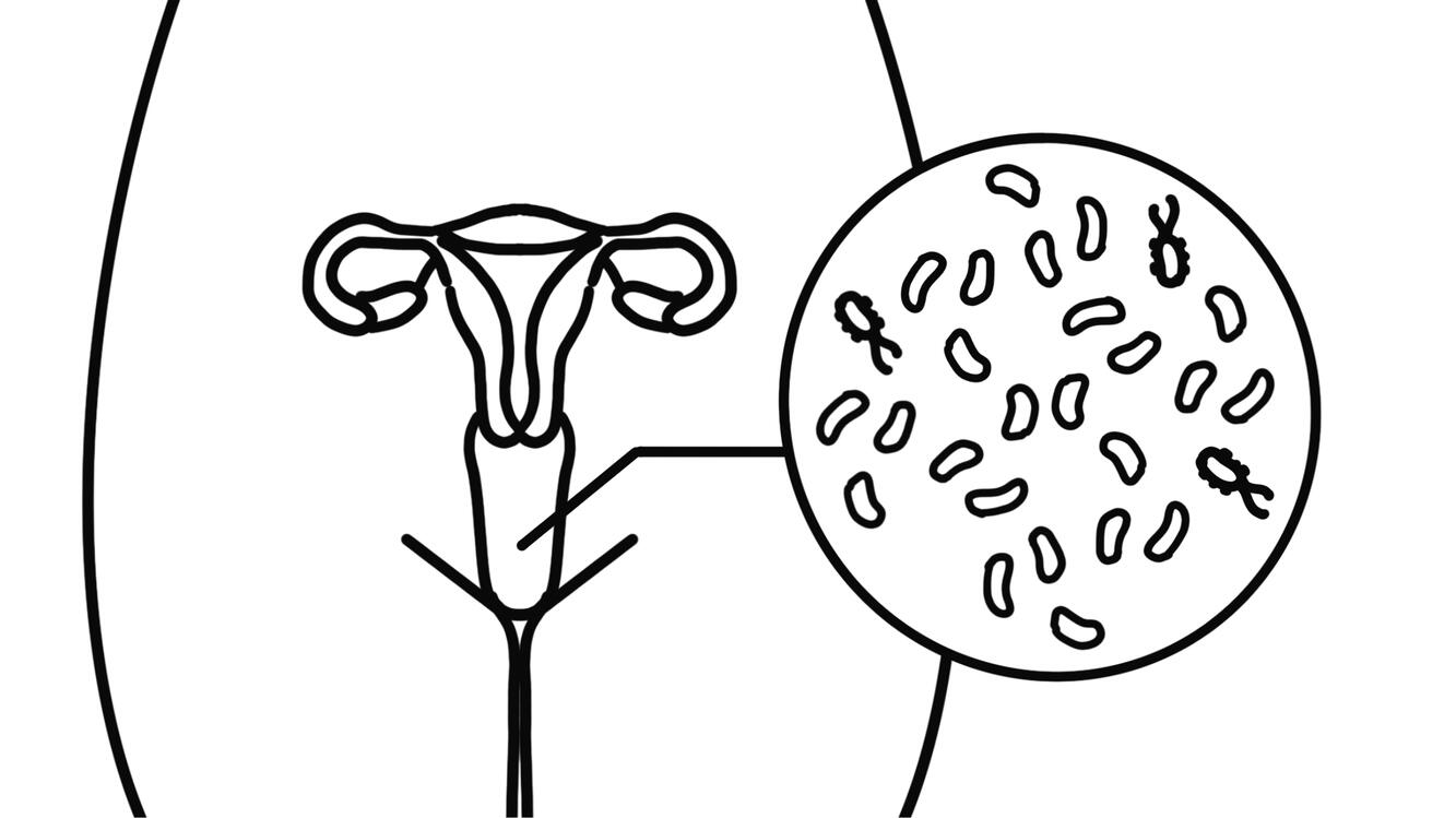 Vaginal pH balance matters.